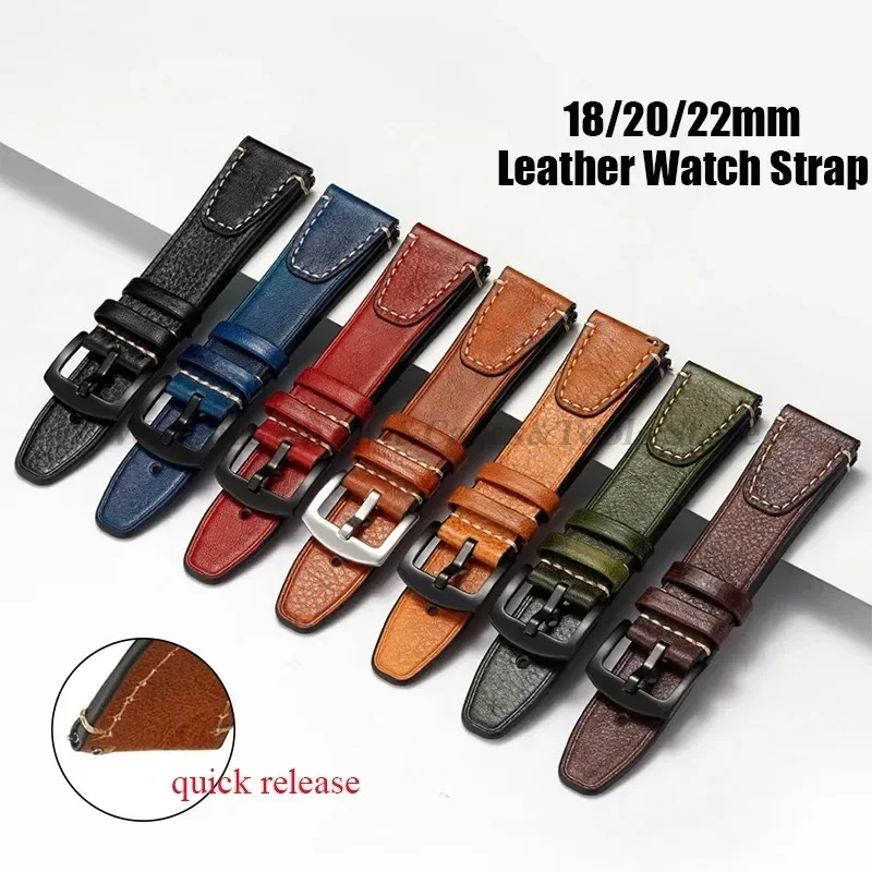 Universal Retro Watchband for  - مراجعة Watches Rolex Smartwatch وسعره
